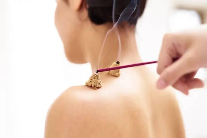 お灸とは?初心者でもわかる効果とやり方、注意点を徹底解説