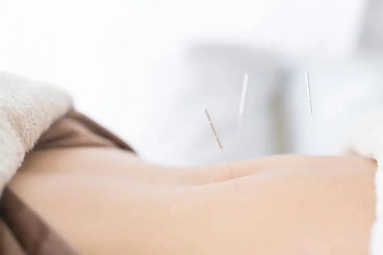 お腹を整える鍼治療|鍼の効果で胃腸を活性化